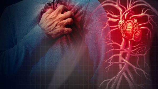 أسباب الذبحة الصدرية