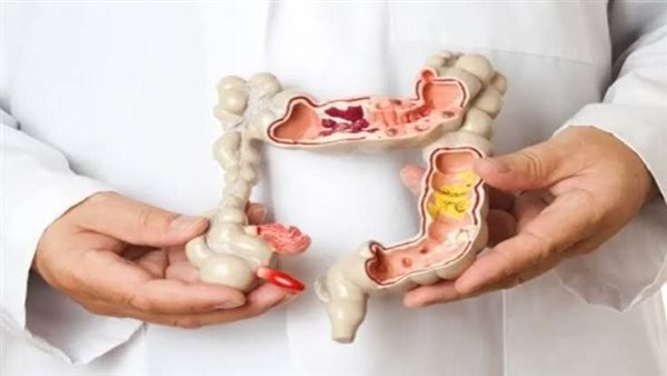 أعراض الزائدة الدودية