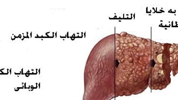 صورة توضيحية لمراحل