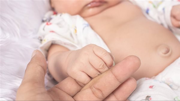 أعراض الفتق عند الأطفال