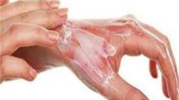 أخطاء شائعة عند الإصابة