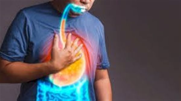 أعراض الارتجاع المريئي