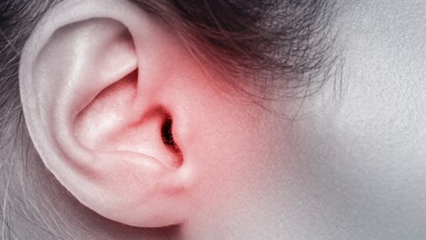 علاج التهاب الأذن