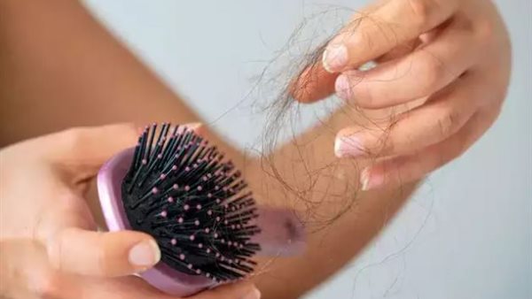 تساقط الشعر