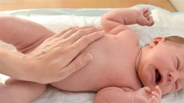 أعراض الفتق عند الأطفال