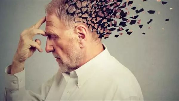 أسباب ضعف الذاكرة