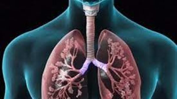 أعراض الإصابة بالانسداد