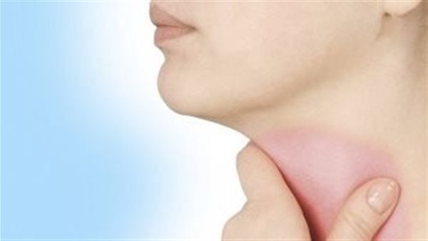 أسباب التهاب الحلق
