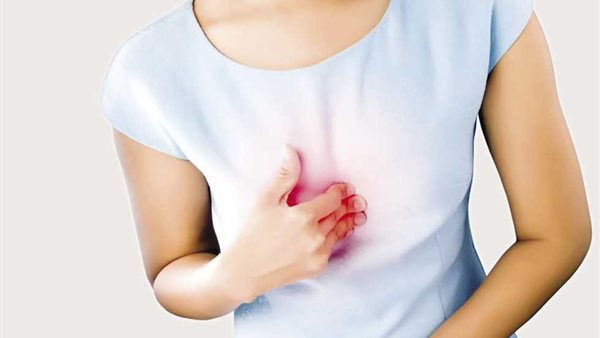 ارتجاع حمض المعدة