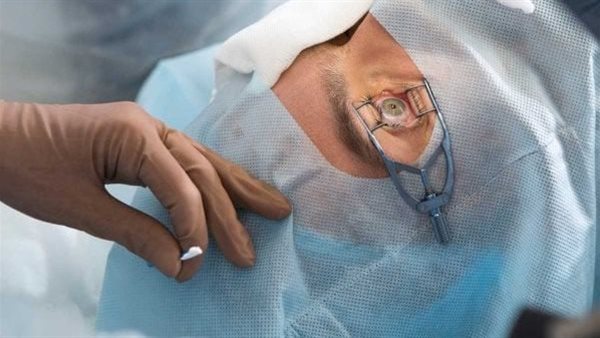 علاج حول العين