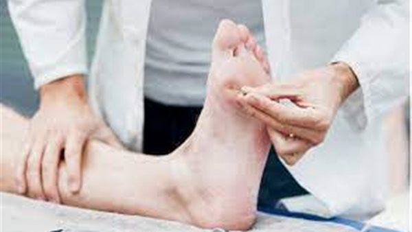 علاج التهاب الأعصاب
