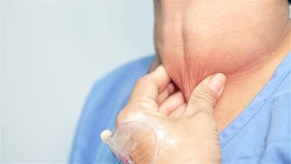أعراض تضخم الغدة