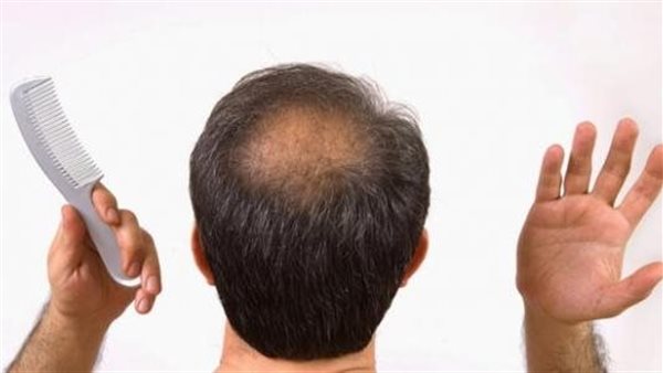 أسباب تساقط الشعر