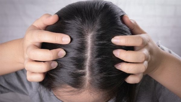 علاج سريع لتساقط