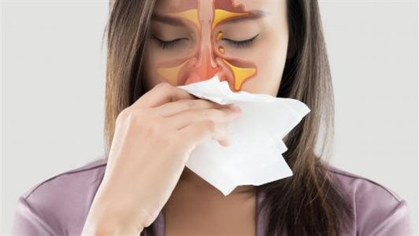 أعراض حساسية الأنف