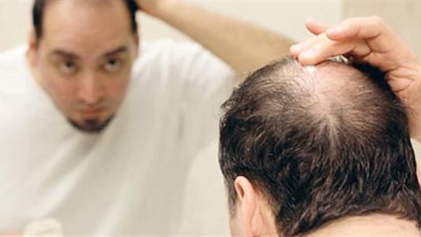 سبب تساقط الشعر عند