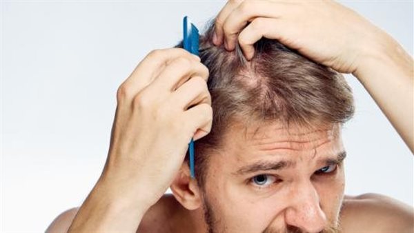 أسباب تساقط الشعر