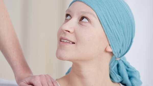 تساقط شعر مرضى الأورام