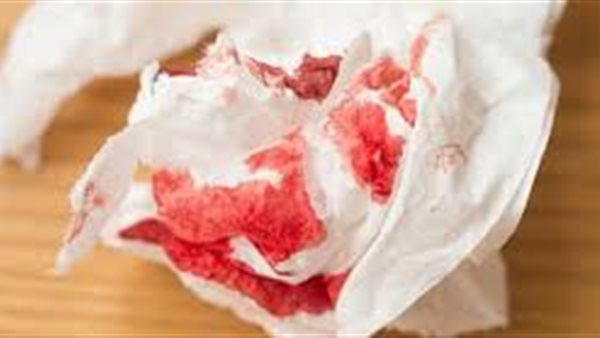 متى يكون النزيف خطرًا؟