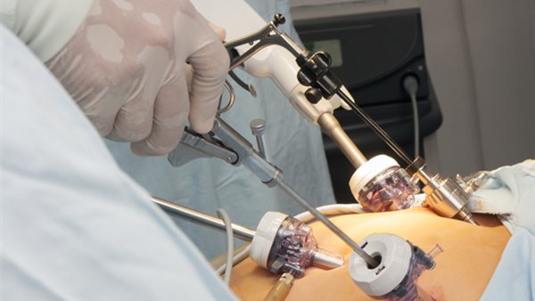 التدخل الجراحي لعلاج