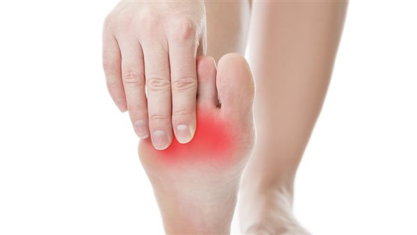 علاج التهاب الأعصاب