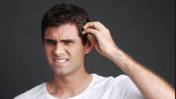 حكة فروة الرأس