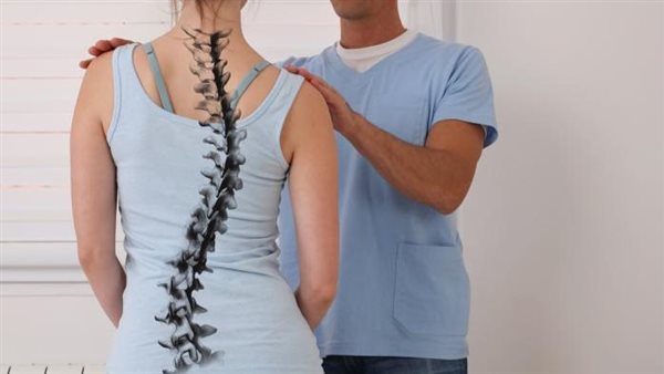 علاج تقوس الظهر