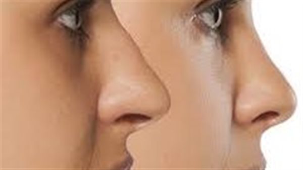 ماهى أعراض انحراف