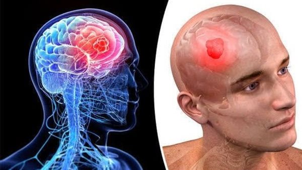 كدمات الرأس