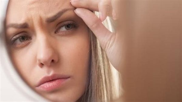 تساقط شعر الحاجب