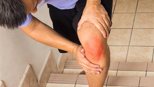 أعراض التهاب المفاصل