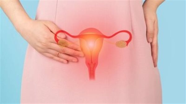 أعراض تكيسات المبايض