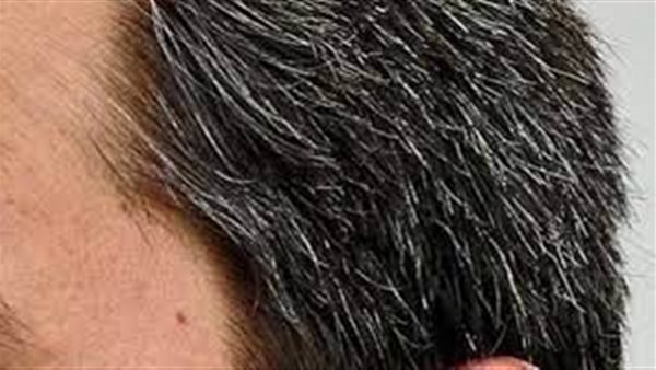 ظهور الشعر الابيض