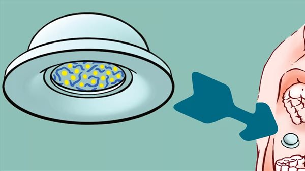 كوب حقن