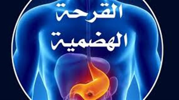 القرحة المعوية والهضمية