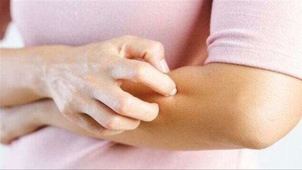 أعراض مرض السيلياك
