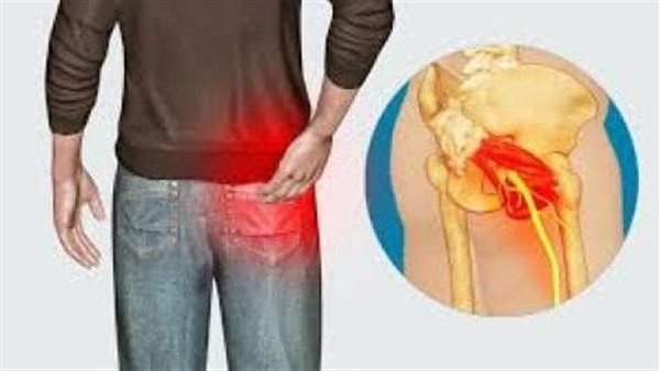 ما هي أعراض متلازمة