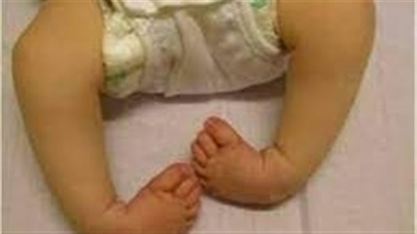 ما هى القدم المخلبية