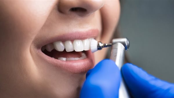 ما علاج اهتزاز الأسنان