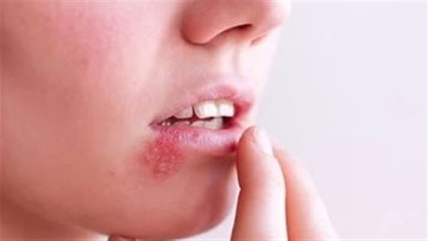 طرق انتقال ابشتاين