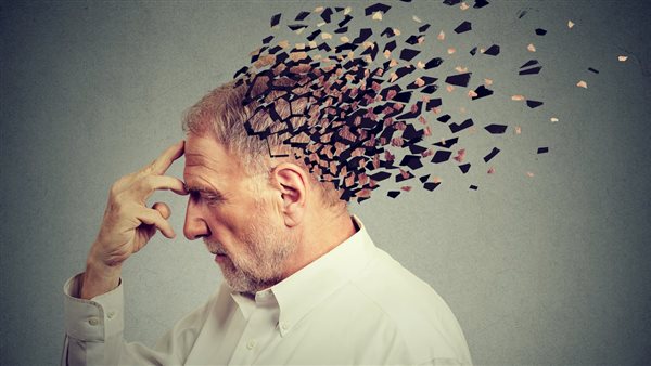 آلزهايمر