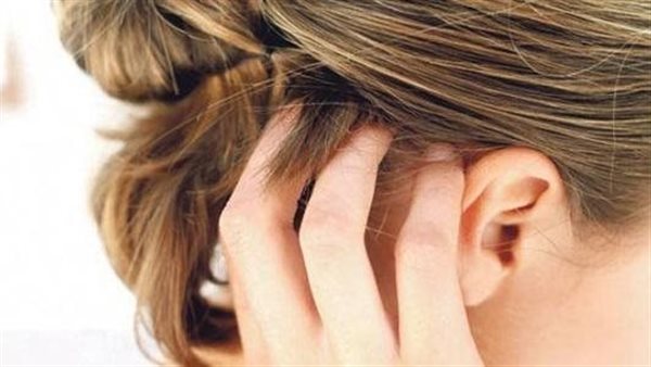 حبوب في فروة الرأس..