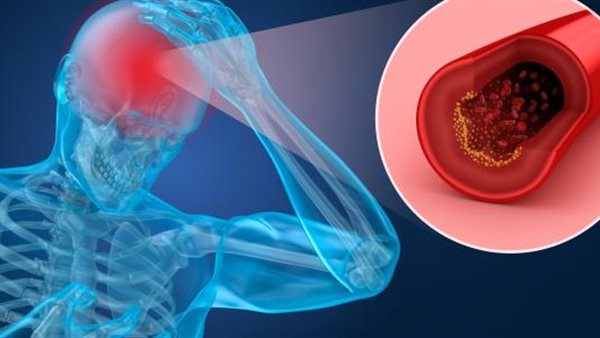 أعراض إقفار الأمعاءأعراض