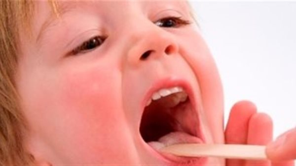 أعراض التهاب الحلق