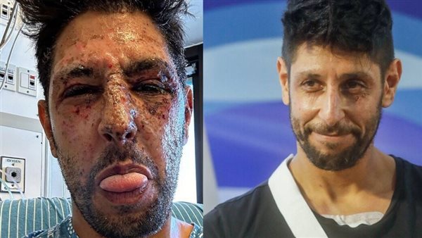الممثل الإسرائيلي