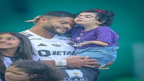 ما هى متلازمة كورنيليا