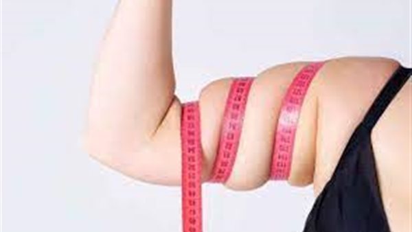 ترهلات الذراعين