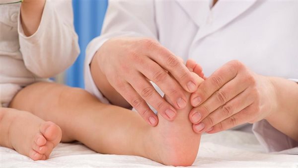 علاج القدم المسطحة