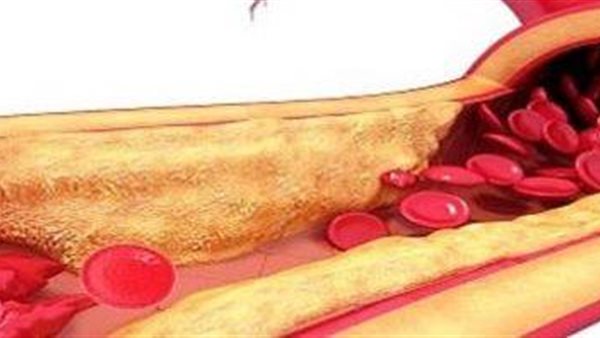 علاقة الكوليسترول