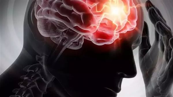 أعراض متلازمة هافانا